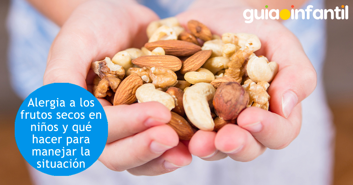 Alergia a los frutos secos en niños