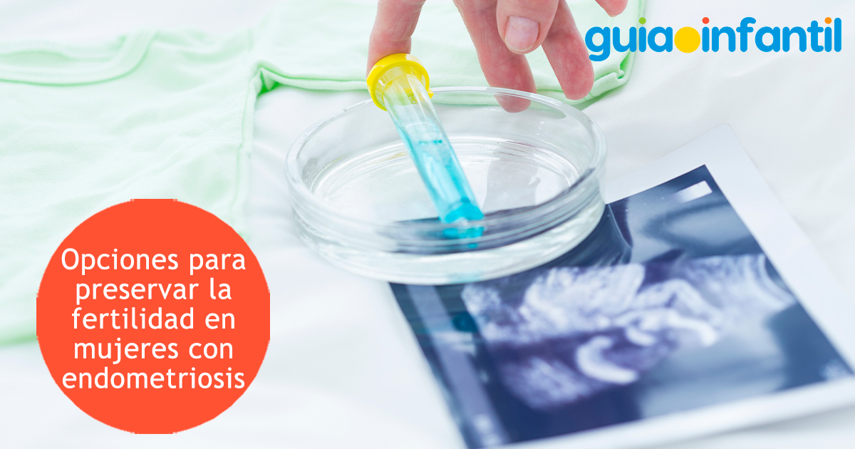 Preservar la fertilidad en las mujeres