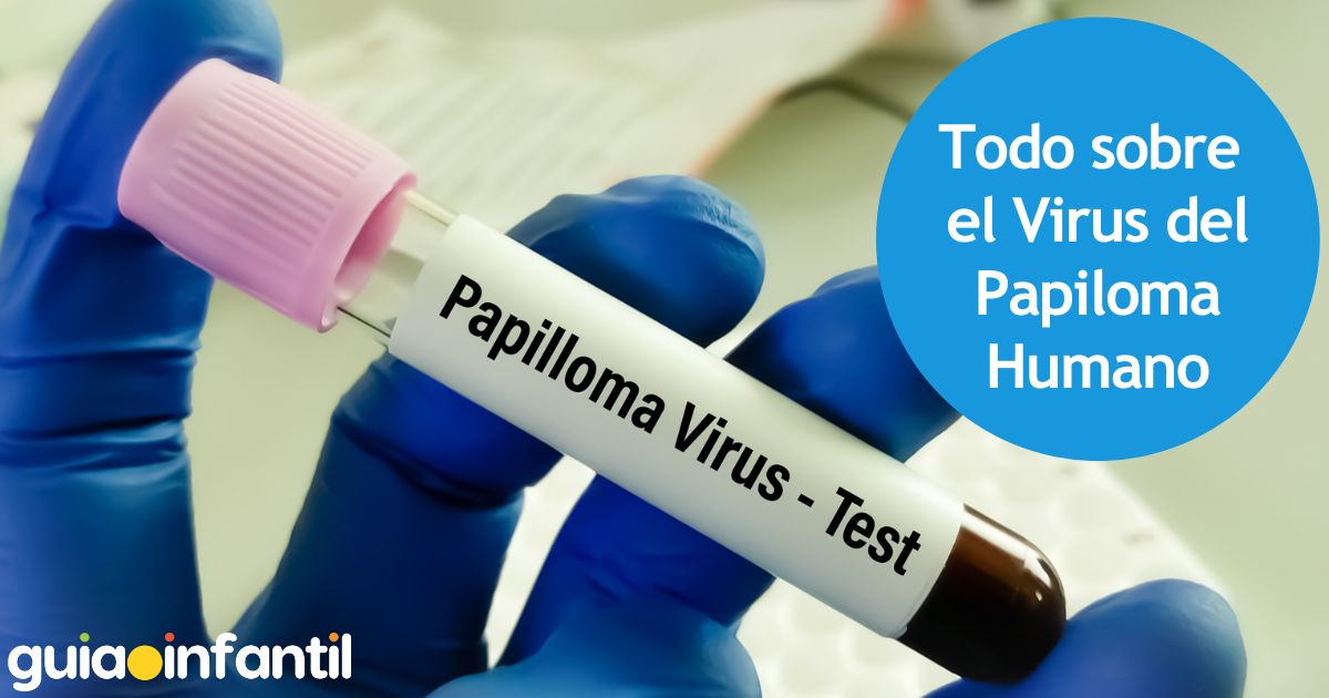 Todo sobre el Virus del Papiloma Humano
