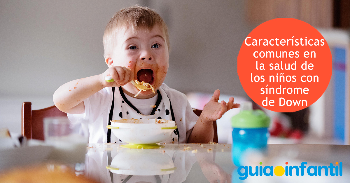 Características de los niños con síndrome de Down