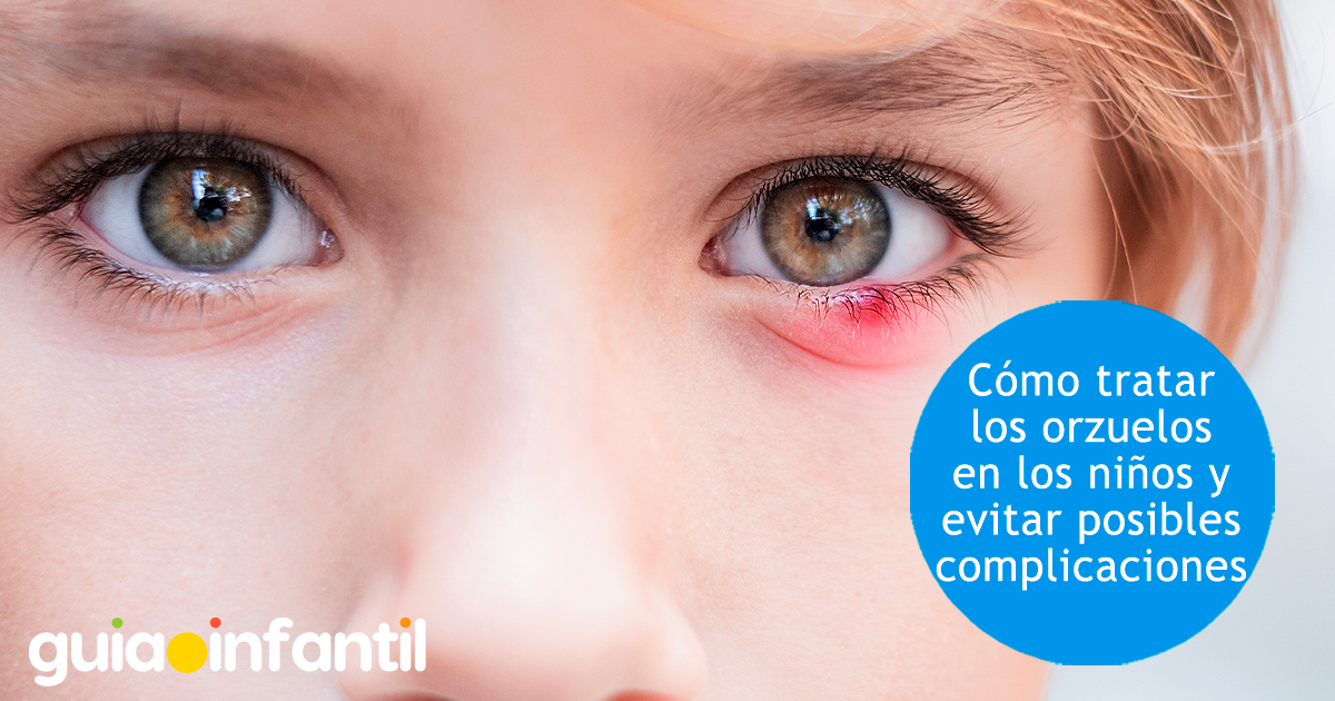 Cómo tratar orzuelos en niños