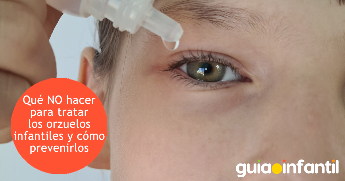 Qué NO hacer al tratar los orzuelos