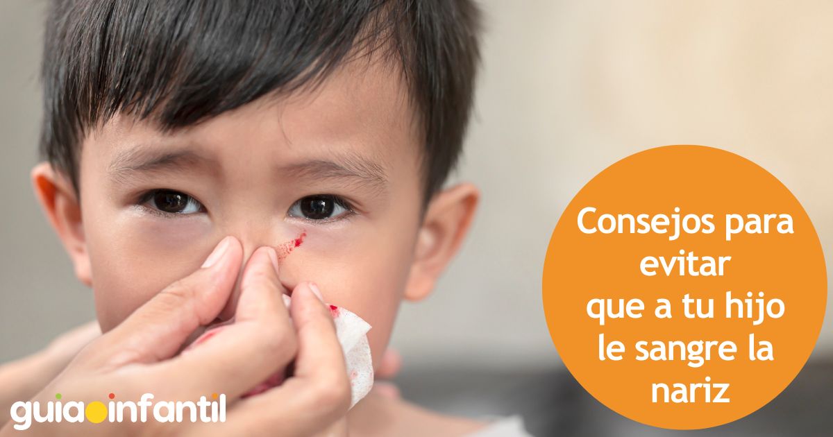 Consejos para evitar que a tu hijo le sangre la nariz