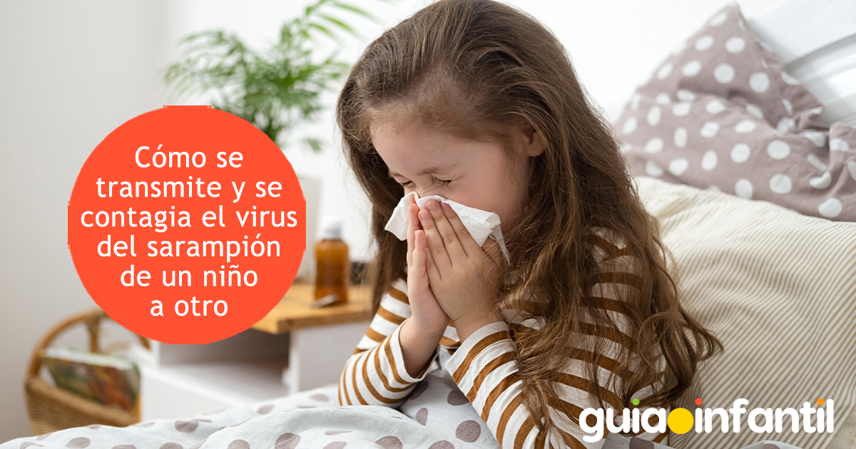 Cómo se contagia el sarampión