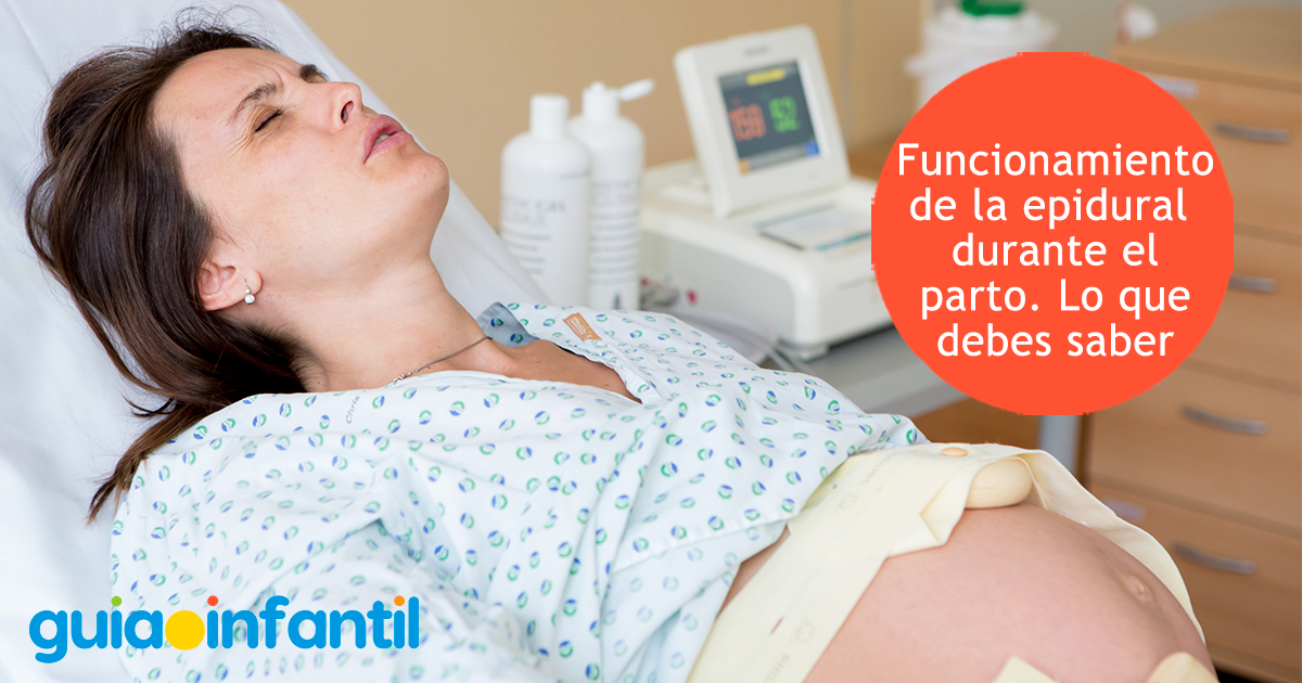 Funcionamiento de la epidural
