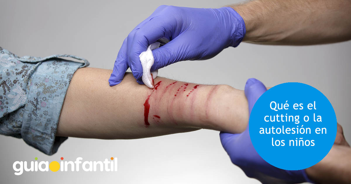 qué es la autolesión en niños