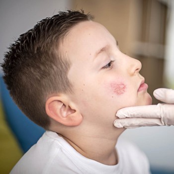 Autolesiones en niños: ¿por qué un niño se hiere a sí mismo?
