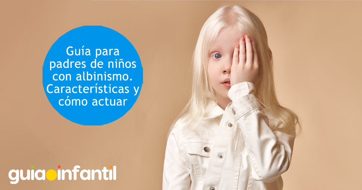 Guía para padres de niños con albinismo