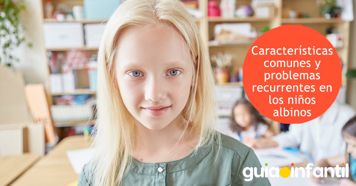 Características de los niños albinos