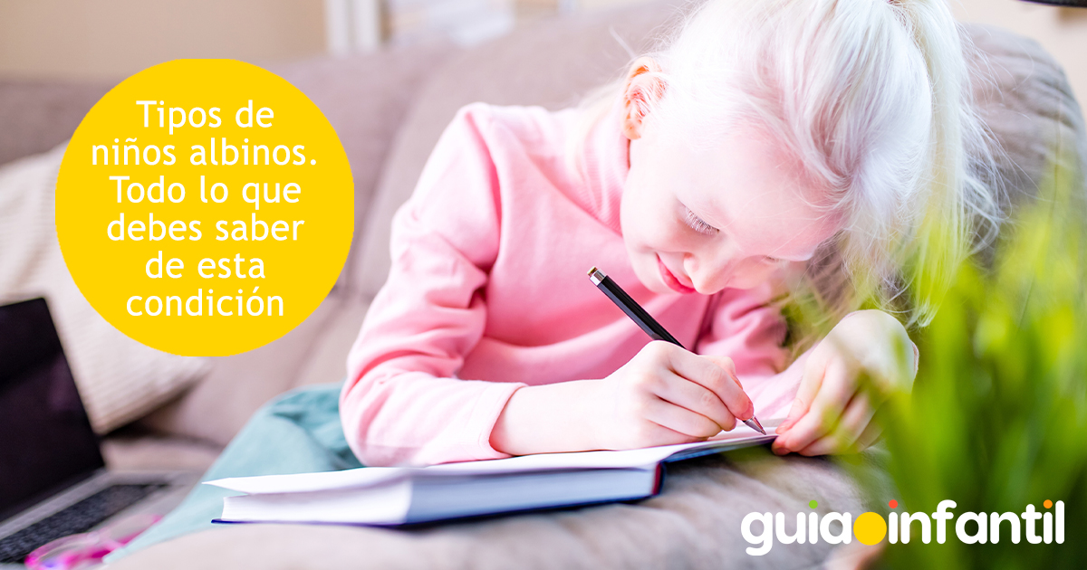 Tipos de niños albinos