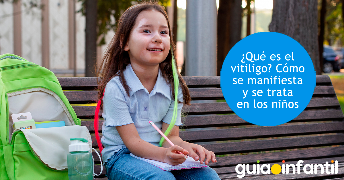 Causas y síntomas de vitiligo infantil