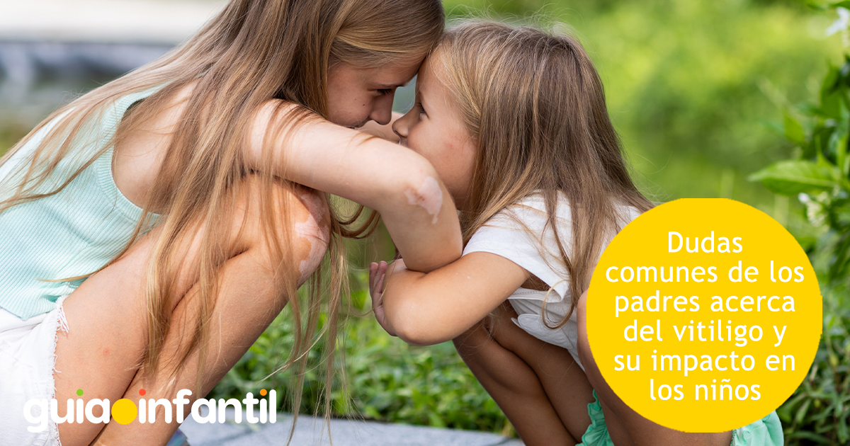 Dudas de los padres sobre el vitiligo de los niños
