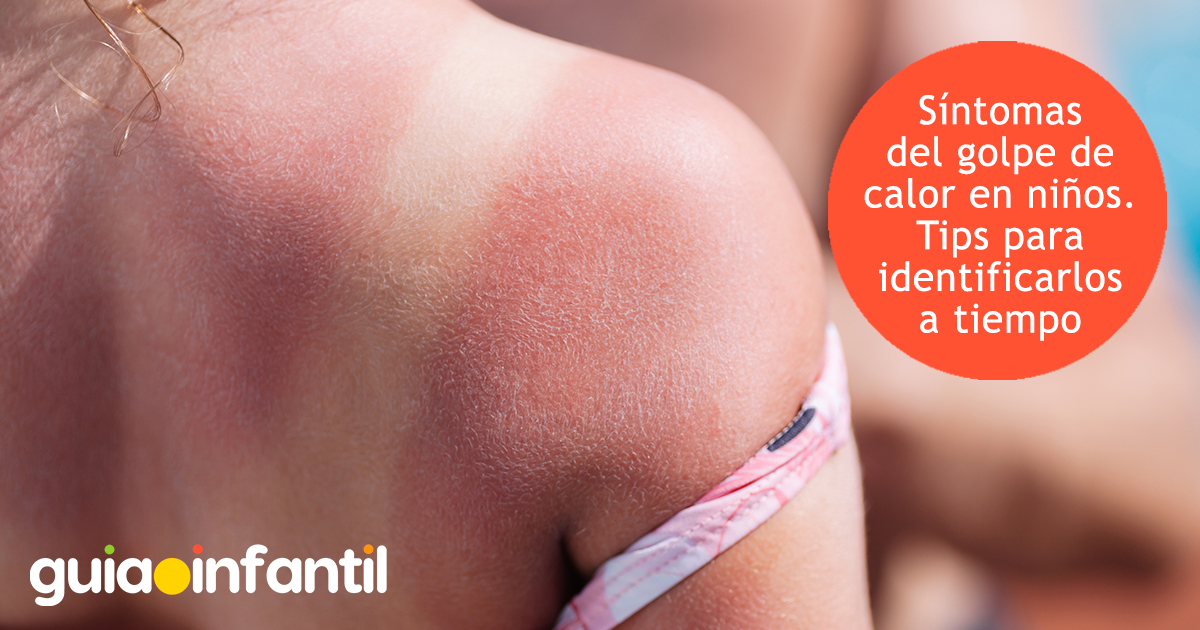 Síntomas de golpe de calor en niños