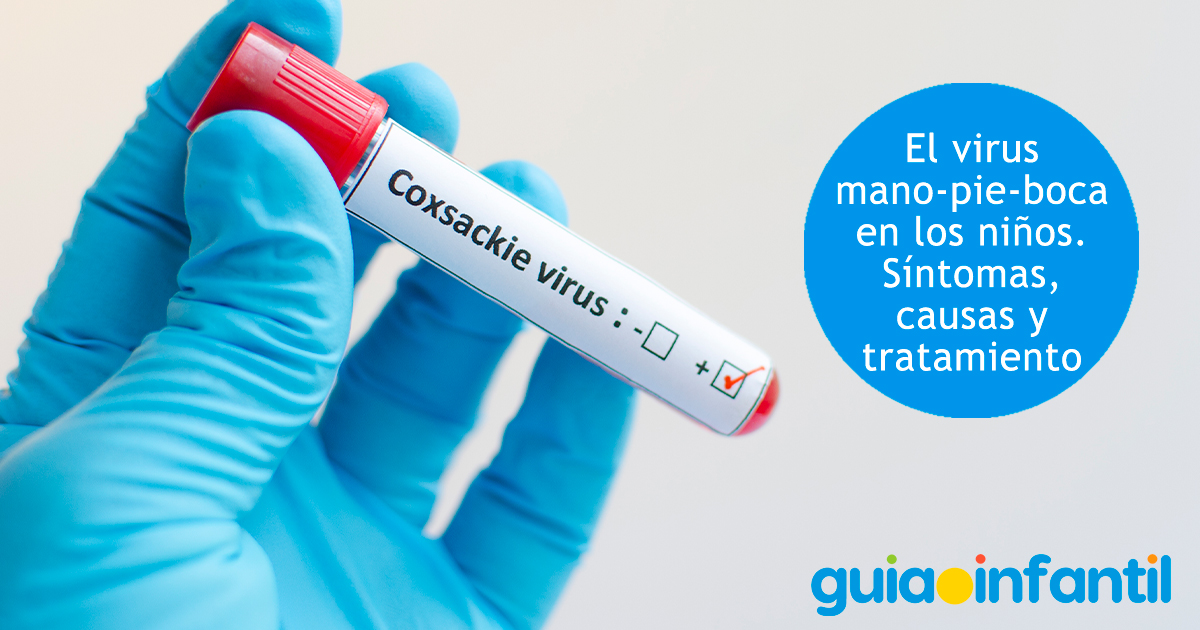 Virus del coxsackie en los niños