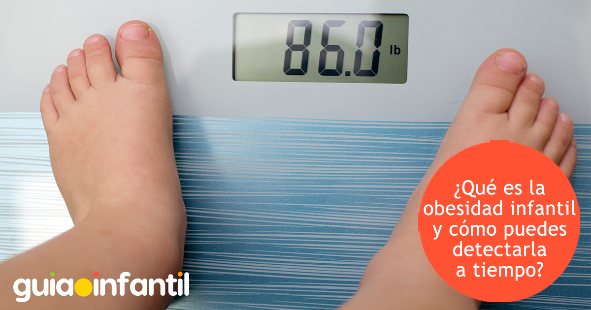 ¿Qué es la obesidad infantil?