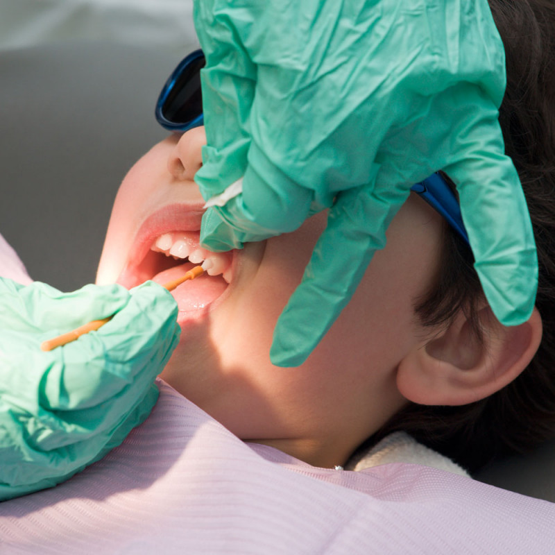 ¿Cómo evita la caries en los niños la fluorización dental?