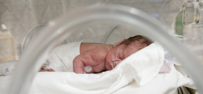 problemas bebés prematuros