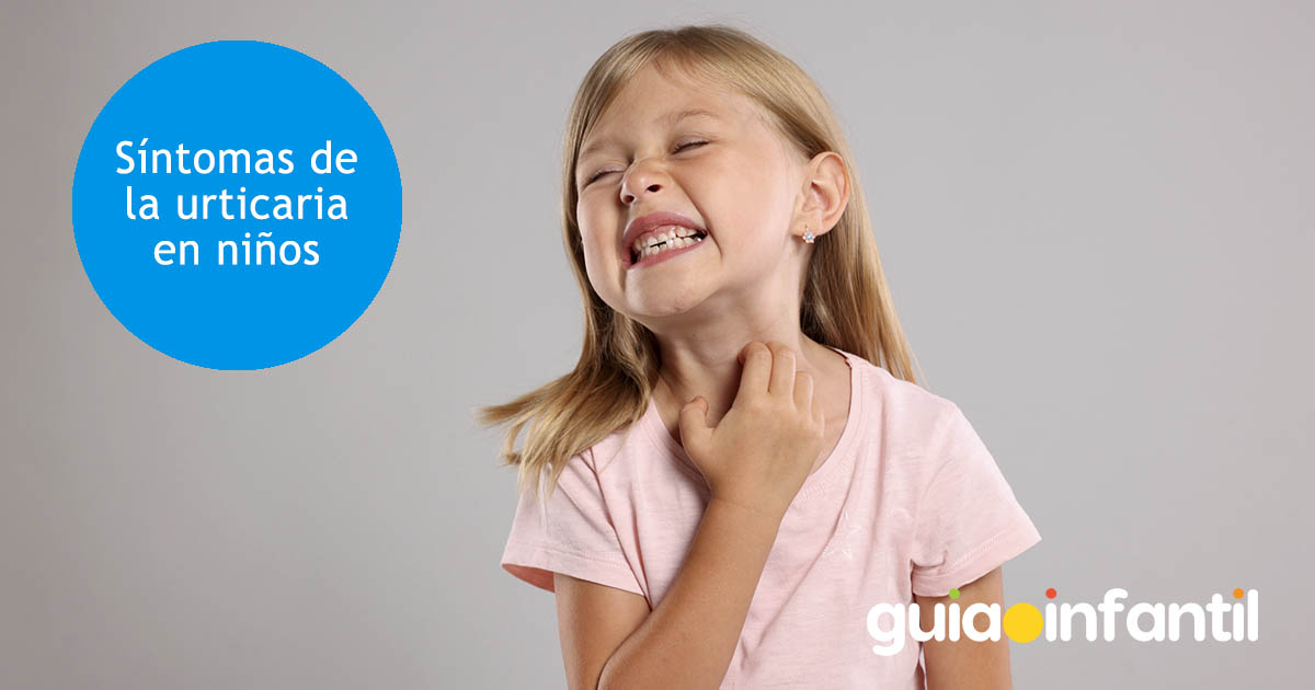 Urticaria en bebés y niños
