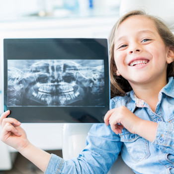 Principales problemas derivados de la mordida cruzada en niños