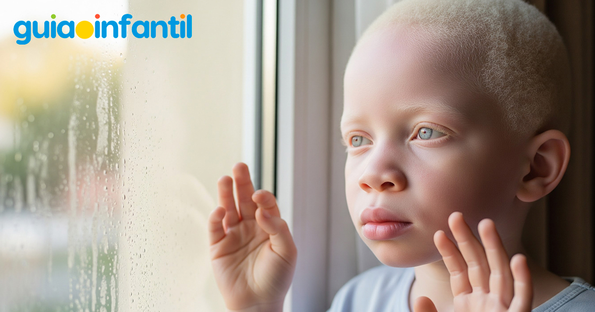 Albinismo en los niños