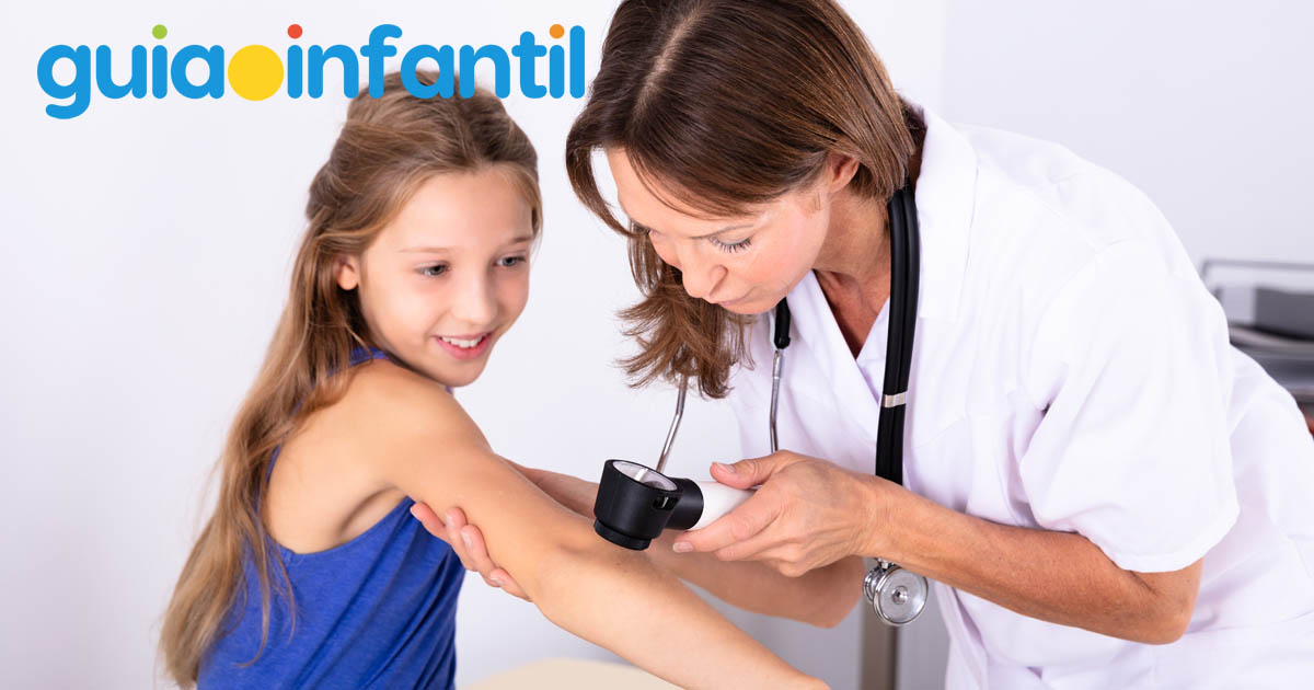 lunares en los niños cáncer de piel