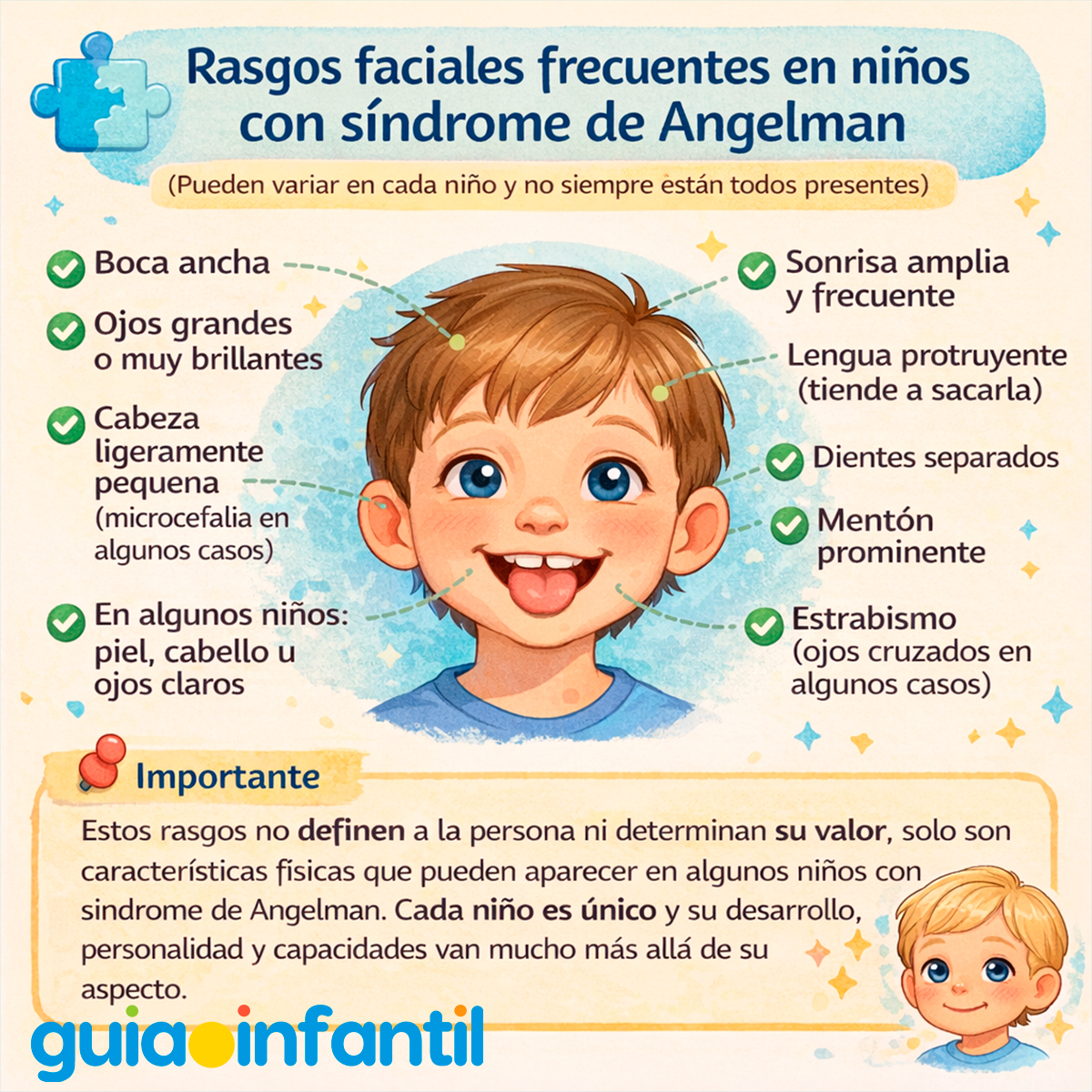 Características de los niños con Síndrome de Angelman
