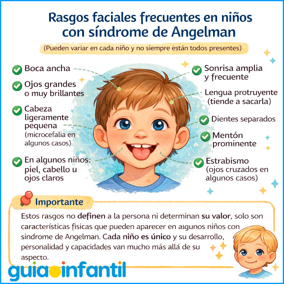  niños con Síndrome de Angelman