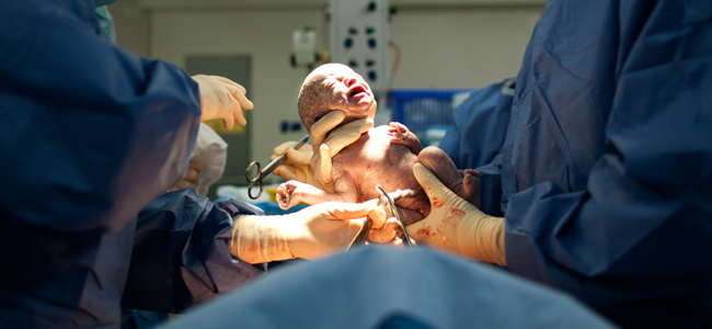 parto instrumental parto natural