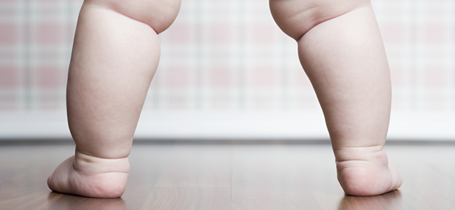 la obesidad infantil
