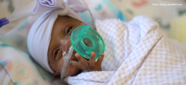 el bebé más pequeño del mundo