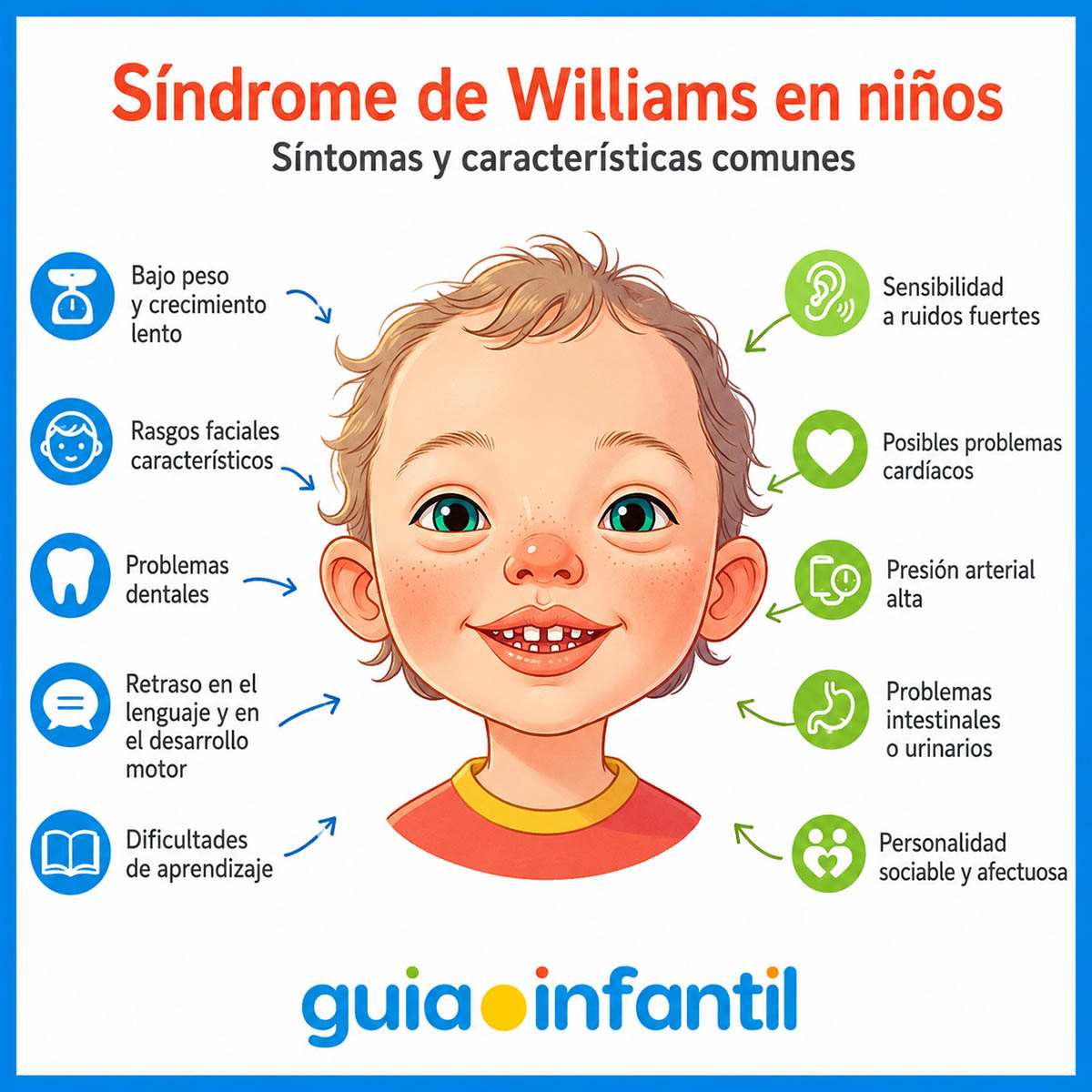 Caraterísticas del síndrome de Williams en los niños