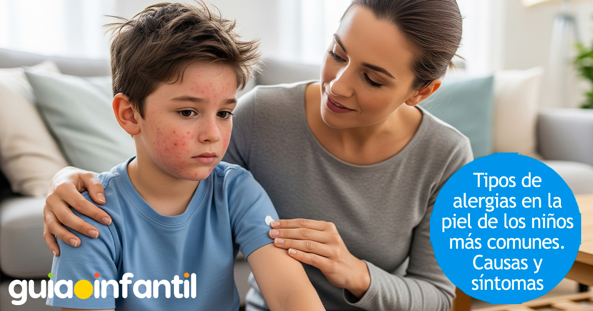 Tipos de alergias en los niños
