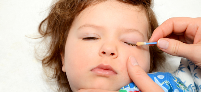 Conjuntivitis enfermedades infantiles
