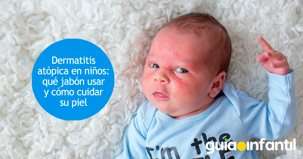Jabones para la dermatitis atópica en niños
