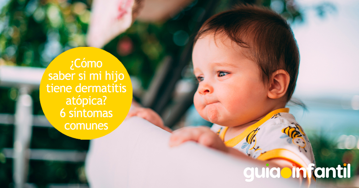 Cómo saber si un niño tiene dermatitis atópica