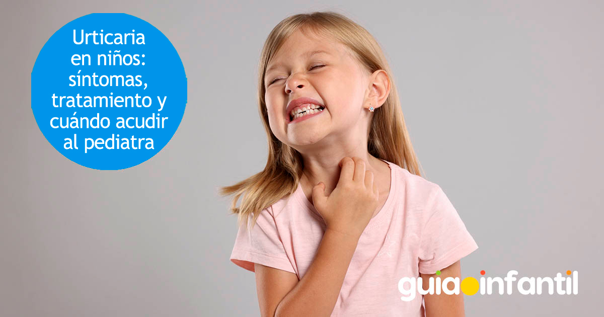 Urticaria en niños