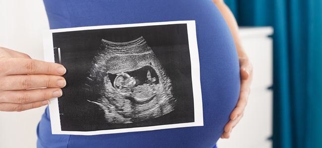 síndrome de banda amniótica