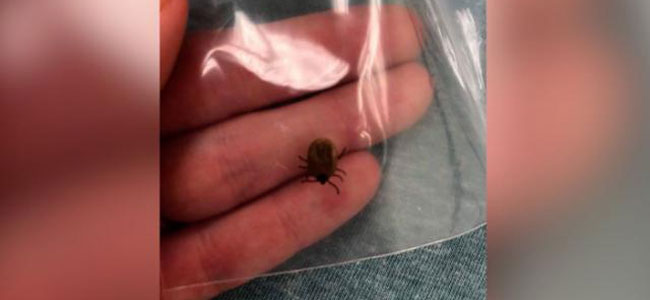 Garrapata en la piel de un niño