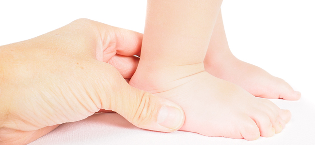 alternaciones pies nios