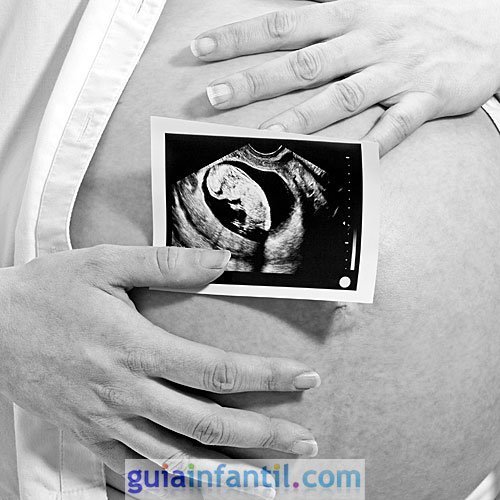 La foto de la ecografía o ultrasonido del bebé