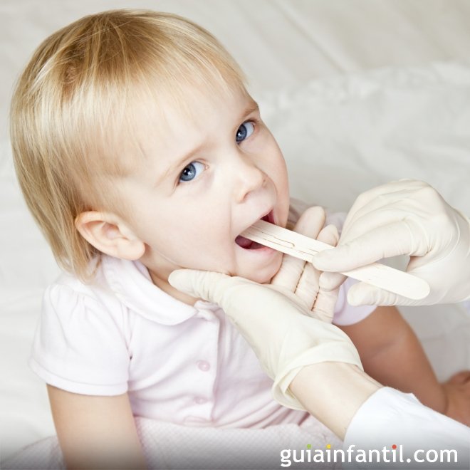 Anginas y faringitis. Enfermedades infantiles comunes