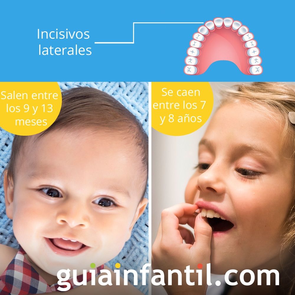 Los dientes incisivos laterales salen entre los 9 y 13 meses de edad y se caen entre los 7 y 8 años.