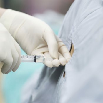 Cómo se aplica la anestesia epidural en el parto