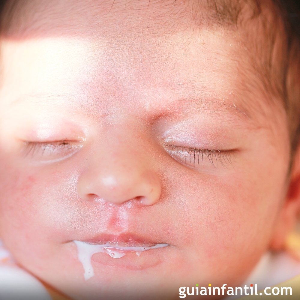 Cuando el bebé vomita la leche de fórmula. ¿Qué puede indicarnos?