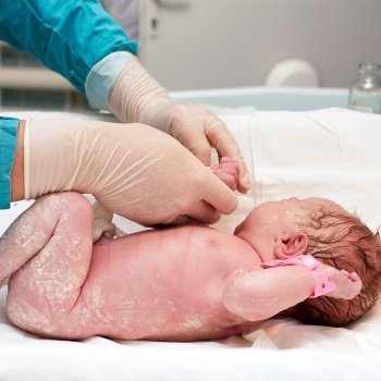 Qué es la vérnix caseosa del recién nacido