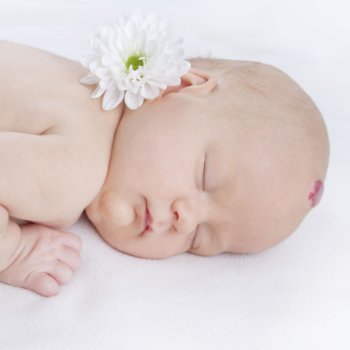 Por qué nacen los niños con hemangiomas en la piel
