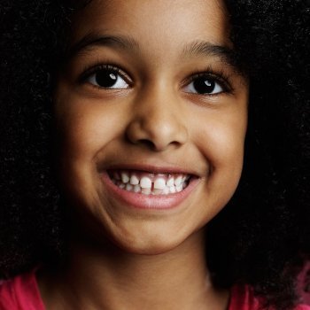 Dientes separados en los niños