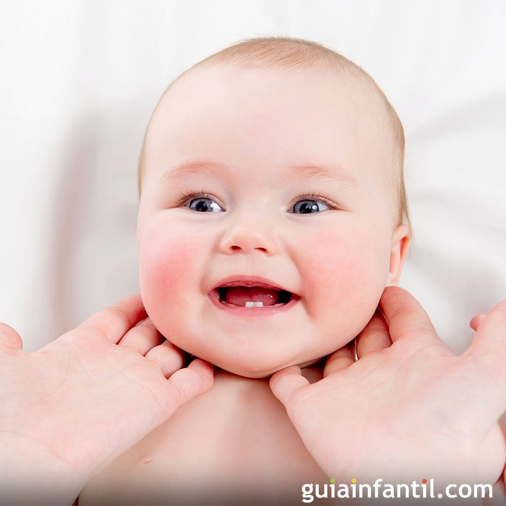 La Torticolis En Recien Nacidos