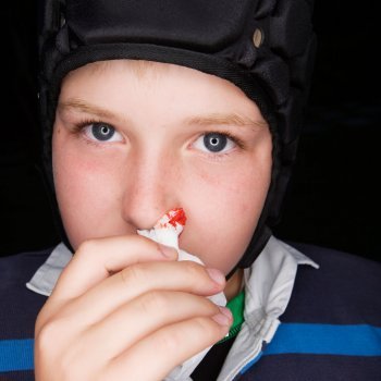 La hemofilia en niños