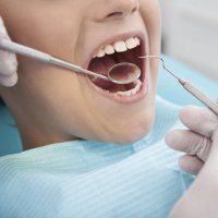 Los dientes definitivos de los niños